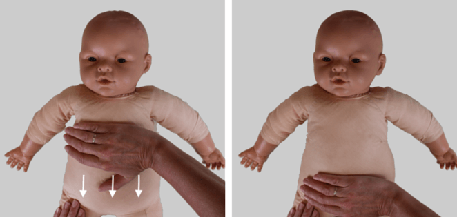 BabyMassage - Lårmassage